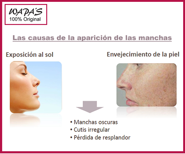 Manchas oscuras de la piel