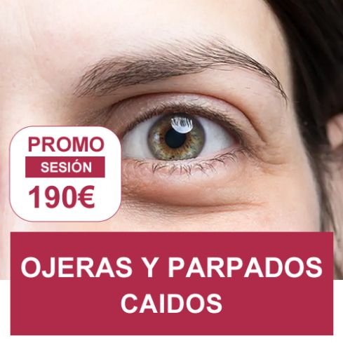 PROMOCION ESTETICA: OJERAS Y PARPADOS CAIDOS