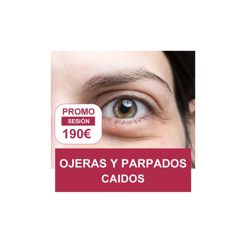 PROMOCION ESTETICA: OJERAS Y PARPADOS CAIDOS