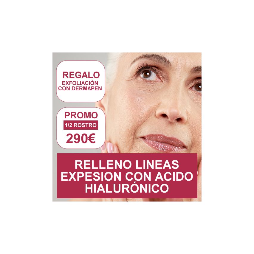 PROMOCION ESTETICA: RELLENO DE LINEAS DE EXPRESION (acido hialuronico)