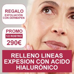 PROMOCION ESTETICA: RELLENO DE LINEAS DE EXPRESION (acido hialuronico)